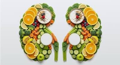 5 Key Dietary Habits to Prevent Kidney Stones