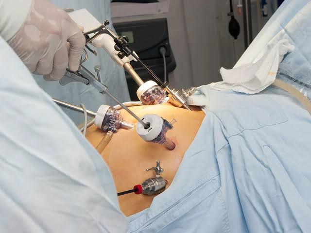 Keyhole & Laser Procedures in Urology | Modern Treatment