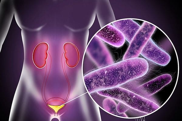 UTI Treatment – Expert Diagnosis & Advanced Care for Urinary Tract Infections in Lucknow
