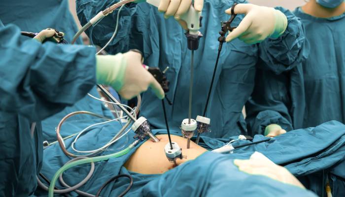 Laparoscopic Urology Surgery – Advanced Minimally Invasive Urological Procedures in Lucknow