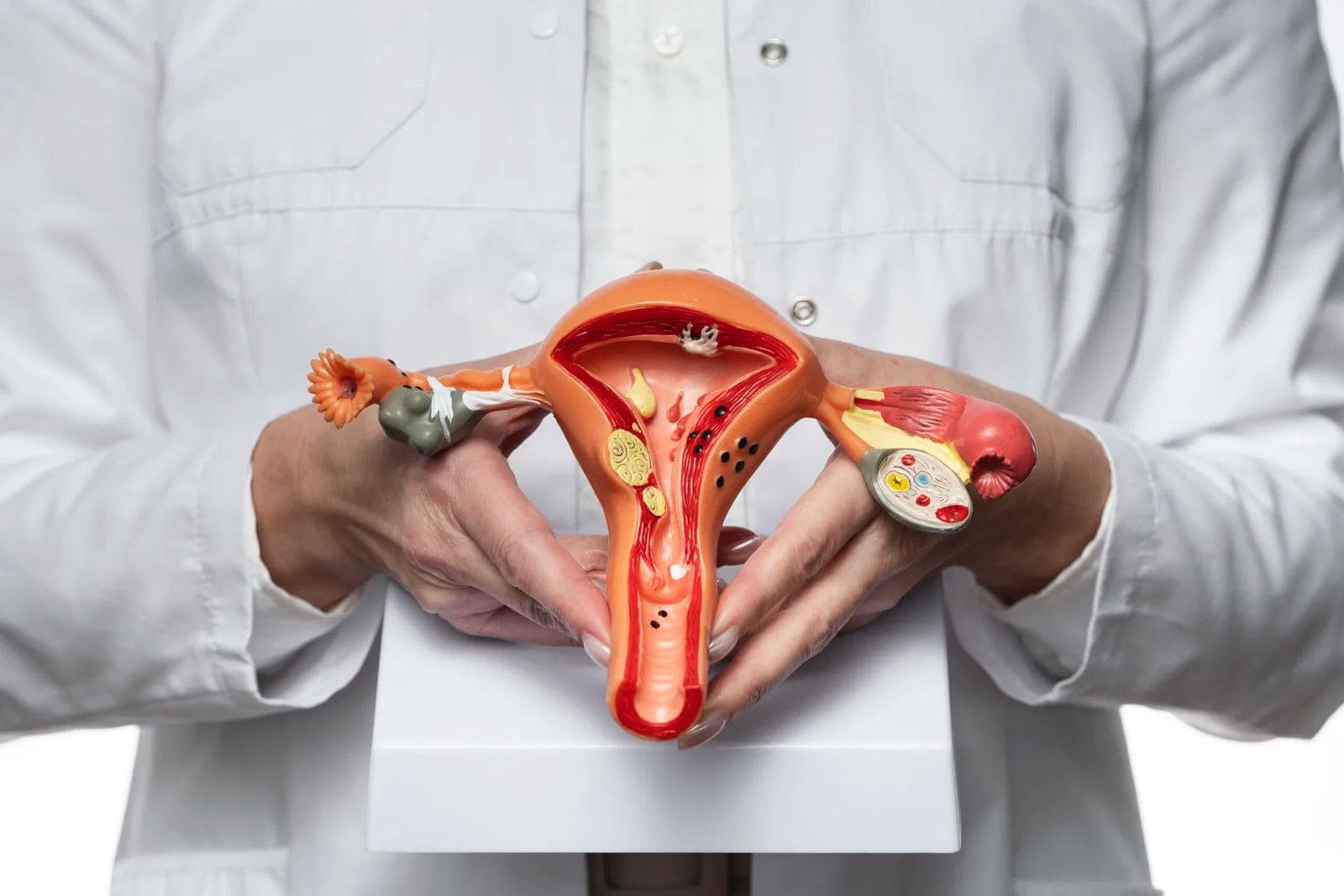 Female Urology – Expert Diagnosis & Treatment for Women's Urinary Health in Lucknow